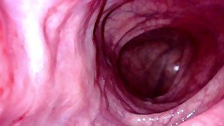 POV - Take a peek around the corner of my transverse colon