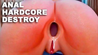 ANAL TEEN HARDCORE DESTROY. AMATEUR PETITE GIRL BIG ASS BIG BOOBS FUCKED HARD BIG COCK IN TIGHT ASS