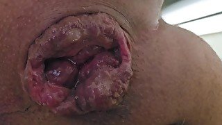 Squeezing Cum from my loose hole