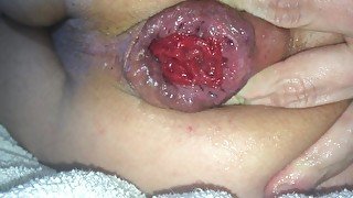 anal fingering and gaping