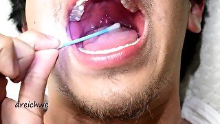 Touching the uvula with swabs