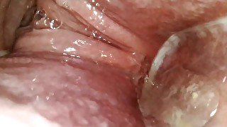 endoscope in my ass and vibrator in my pussy to see the orgasms from my anus