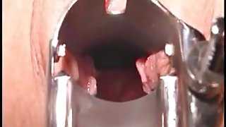 Nurse have a look inside my snatch PT2 DMvideos