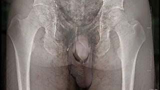 More than skin deep - an x-ray view of my dick!!