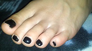 Macro Closeup Of Amateurs Black Toenails