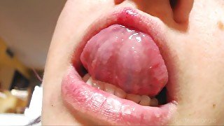 A burning cold sore on my upper lip: I show you my painful herpes blister