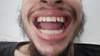 My teeth