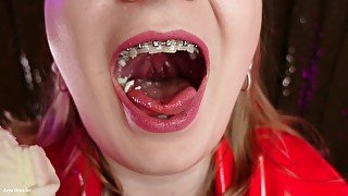 mukbang ASMR eating video FOOD FETISH in braces