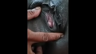  Amazing Huge Pussy Lips ♡¿♡