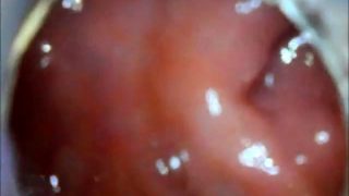 anal endoscope ass play from inside