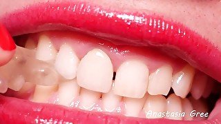 Extremely sharp teeth close-up - Biting jelly