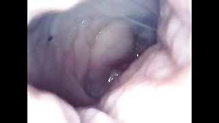 I masturbate with an endoscope in my vagina