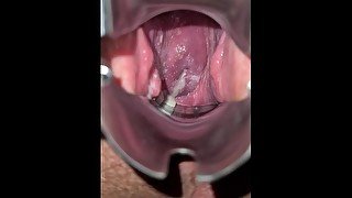 Join my Fans for Endoscope Camera and Speculum Inspections of my Horny Pregnant Cunt and Cervix