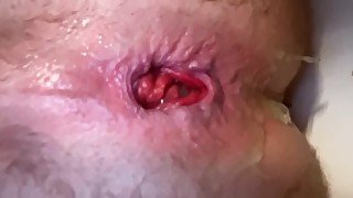 Anal masturbation