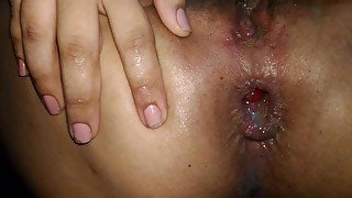 Anal hardcore babe ending whith beautiful prolapse