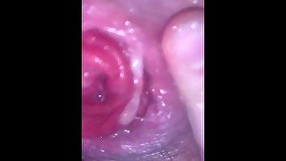 The Video That Got My Snap BANNED [up-close prolapse blossoming]