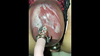 Plug and vibrating bullet and creampie for her pumped up creampied pussy