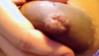 pregnant areola