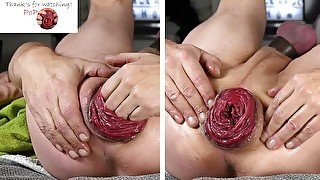 Popoopoop. My beauty prolapse. Self fist. Massage for my rosebud - 27