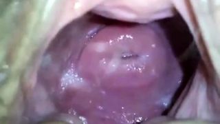 Asian Cervix HD Porn Search - Xvidzz.com