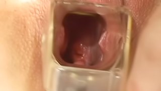 Cock Sucker Gets Speculum In Her Twat