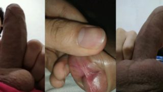 swollen foreskin