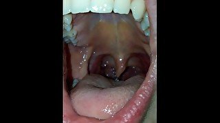 Open Mouth Uvula View