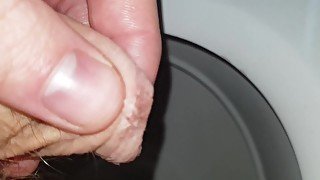 Gross Eczema Inflammation