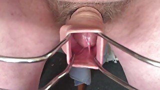 20 minutes foreskin with 3 cumshots !