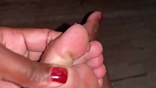 Anyone has a foot fetish? My feet is peeling