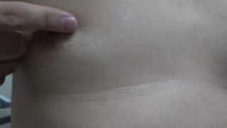 hair removal arround nipples