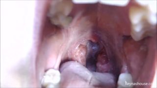 Pre-Op Tonsils PREVIEW - Reyna Mae - BBW Throat Tour Mouth Fetish Uvula Extreme Close Ups Mouth Tour