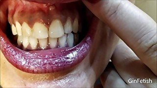 Mouth, uvula, tongue, teeth checks and endoscope