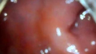 anal endoscope ass play from inside