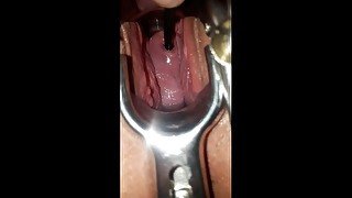 Peehole and cervix penetration