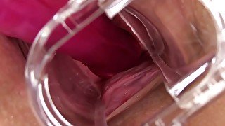 PJGIRLS Macro pussy - Exploration deep inside Nathaly s pussy with speculum