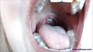 Post Op Tonsils Mouth Tour 3 Weeks - Reyna Mae - BBW MILF Throat Fetish Mouth Fetish Uvula Close Up