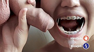 Asian with braces elastics sucks white cock and foreskin