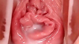 Inside Lauras shaved pussy wit speculum