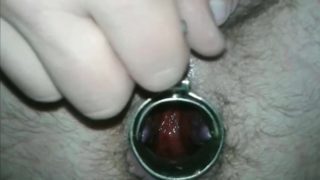 speculum anal