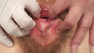 Unshaven pussy extreme Karla visits a doc