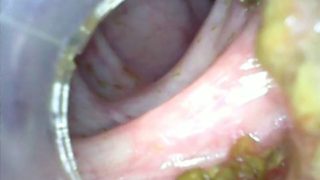 Deep deep anal again home colonoscopy endoscope part 1