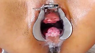 speculum pussy