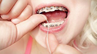 My 2nd day in braces: cleaning by dental floss